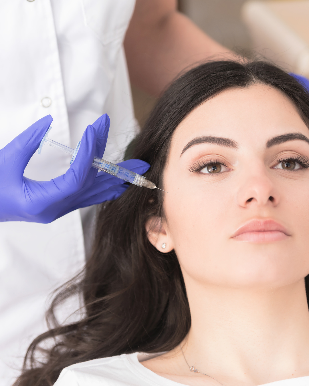 Dermal Cheek filler for defining cheek bones in dubai